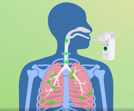 Mini inhalator Medisana IN 525 - zdjęcie 2